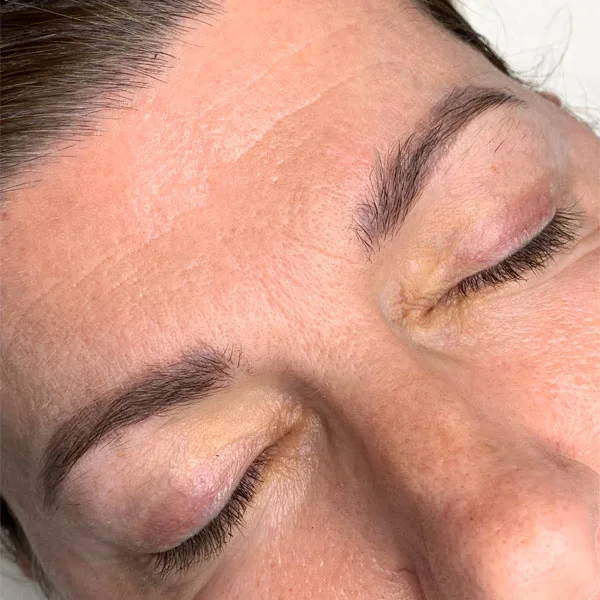 Eyebrow correction before — uneven brows
